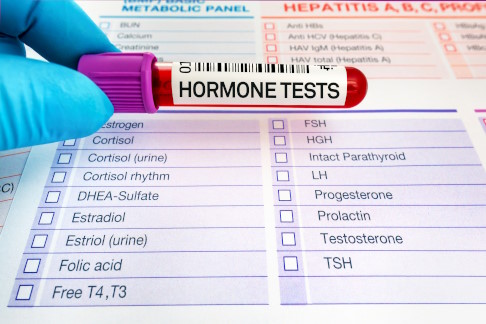 Zettel für Hormondiagnose